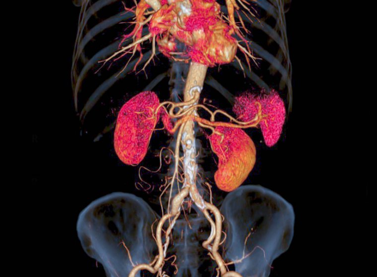 Improving Accuracy of Urologic Cancer Diagnosis 